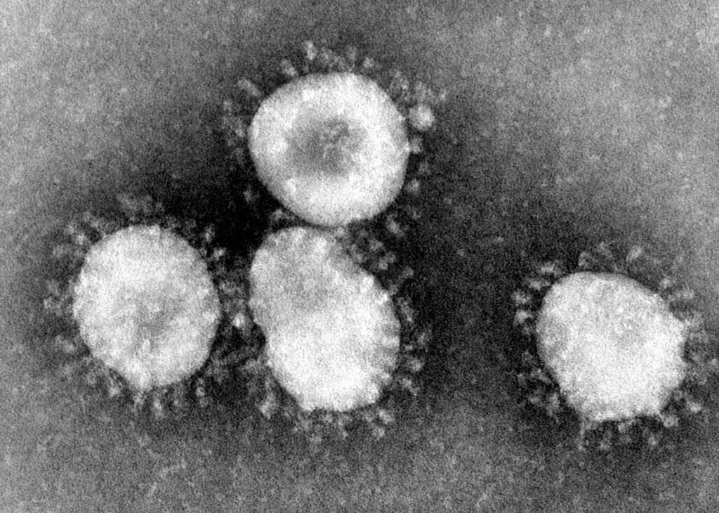 The Coronavirus, A Sign Of Jesus’s Second Coming